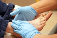 Checking the Bottom of the Feet for Diabetic Patients